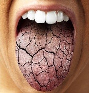 بوی بد دهان