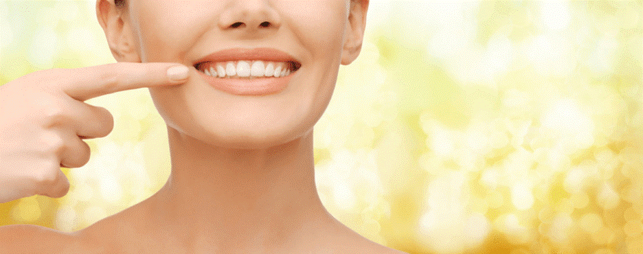 ونیر یا لمینت چیست؟