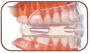 براکسیسم یا دندان قروچه