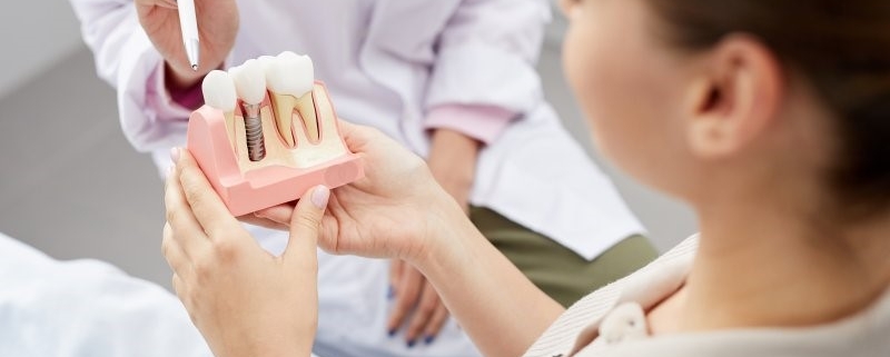 سن کاشت ایمپلنت دندانی
