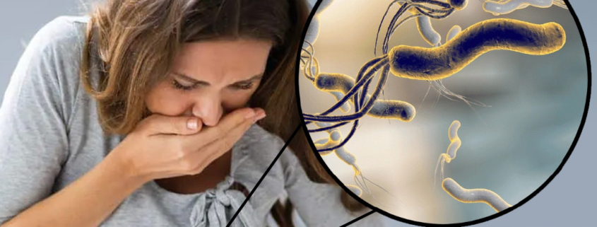 سایر علائم و نشانه های انسداد روده