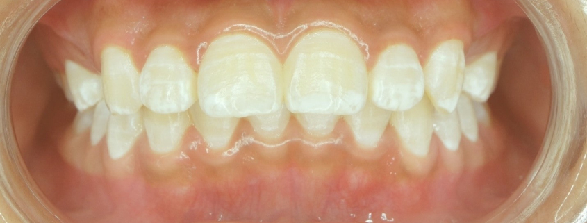 آناتومی دندان