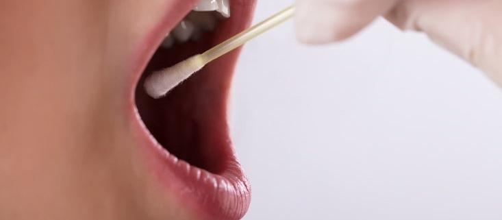 نحوه حفظ pH بهینه بزاق برای بهداشت دهان و دندان