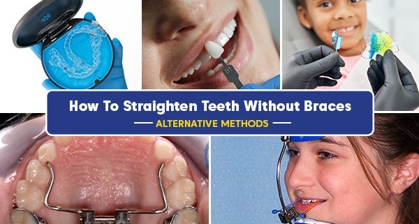 چه افرادی باید دندان های خود را صاف کنند؟