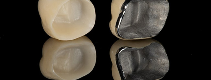 اهمیت معاینه منظم دندانپزشکی