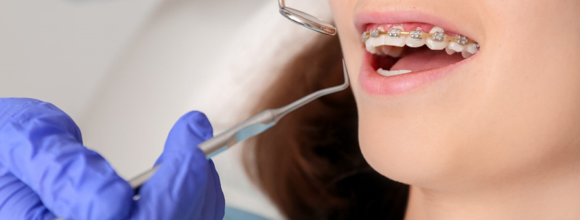 بیماری لثه درمان نشده