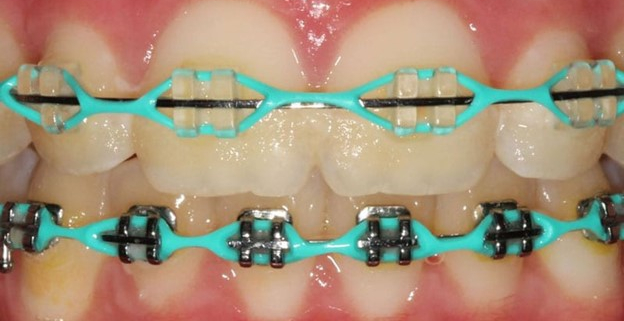 فیروزه ای - درخشش روشن و گرمسیری