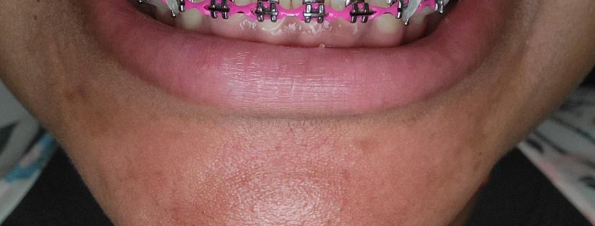 صورتی پررنگ - پاپ رنگ سرگرم کننده و عشوه گر