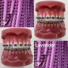 بنفش - انرژی ملکه جسور و باشکوه