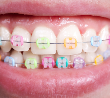 سبز نعنایی پاستلی - جلوه ای با طراوت و سرزنده