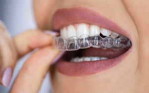 آیا الاینرهای شفاف می توانند آندربایت را اصلاح کنند؟