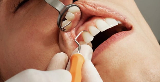 اگر از جرم گیری عمیق دندان خودداری کنید چه اتفاقی می افتد؟